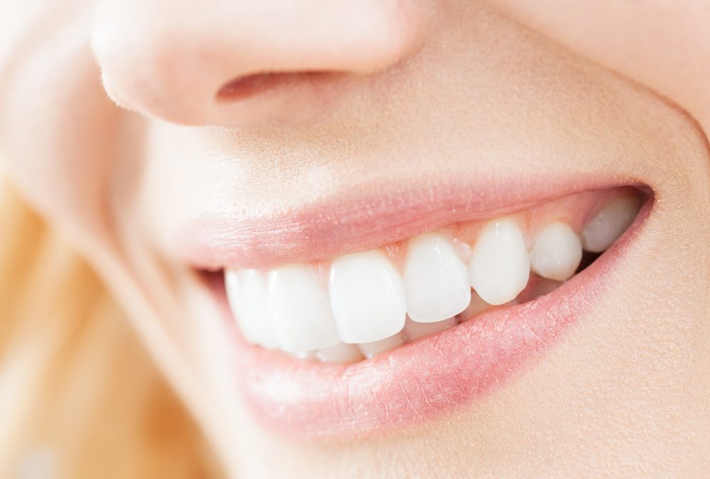 Are Veneers Worth It? A Complete Breakdown of Cost, Benefits, and Long-Term Value