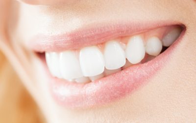 Are Veneers Worth It? A Complete Breakdown of Cost, Benefits, and Long-Term Value